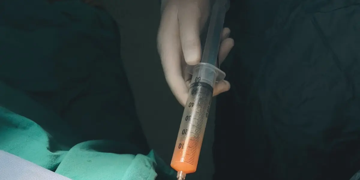 Clinical adipose extraction procedure representing metabolic harvest stock